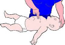 Massage Cardiaque Et Defibrillation Pour Adulte Enfant Nourrisson
